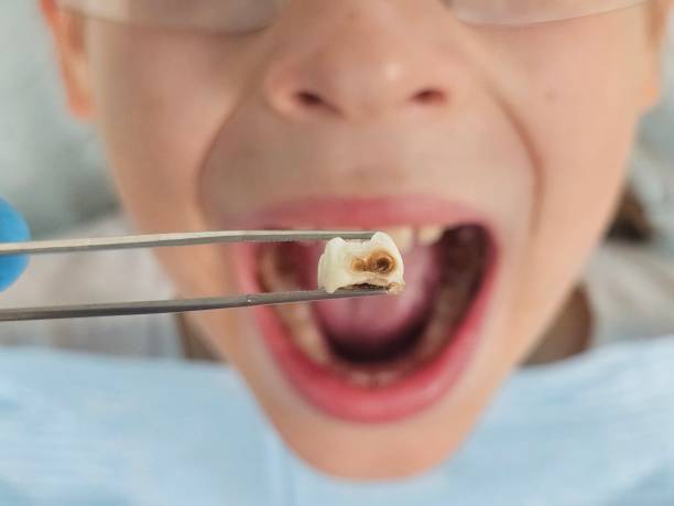 Best Same-Day Emergency Dental Services in Little River Academy, TX