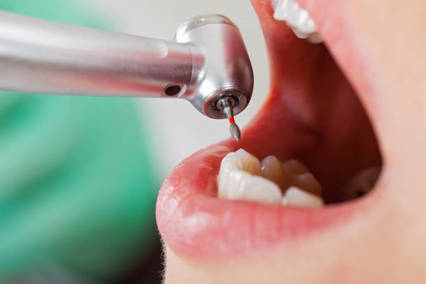 Best Urgent Care for Lost Fillings or Crowns in Little River Academy, TX